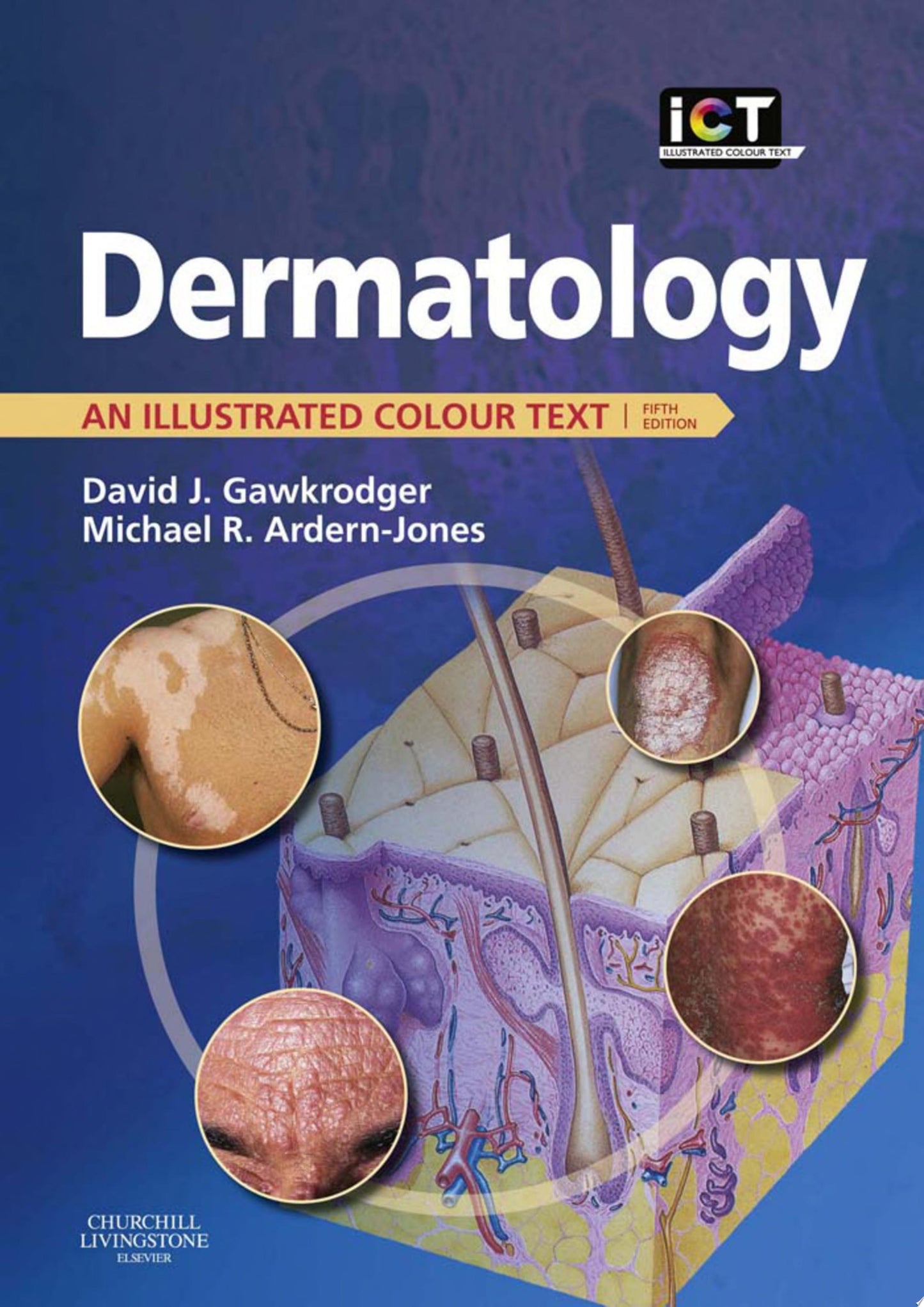 Dermatology: An Illustrated Colour Text, 5th