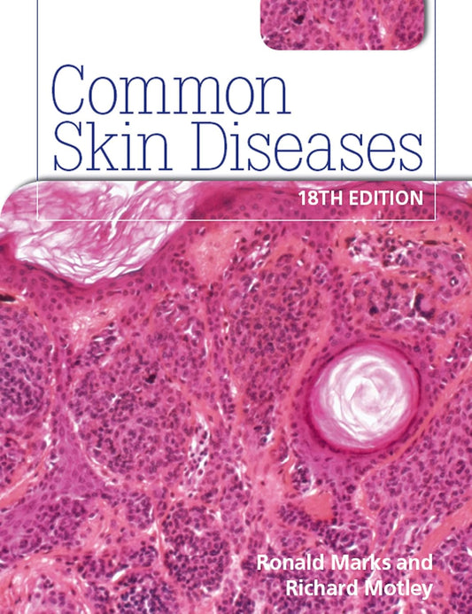 Common Skin Diseases, 18th Edition